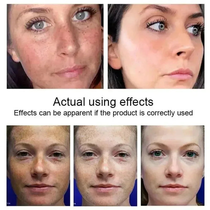 Kojic Acid Brightening Serum – Dark Spot & Tone Corrector