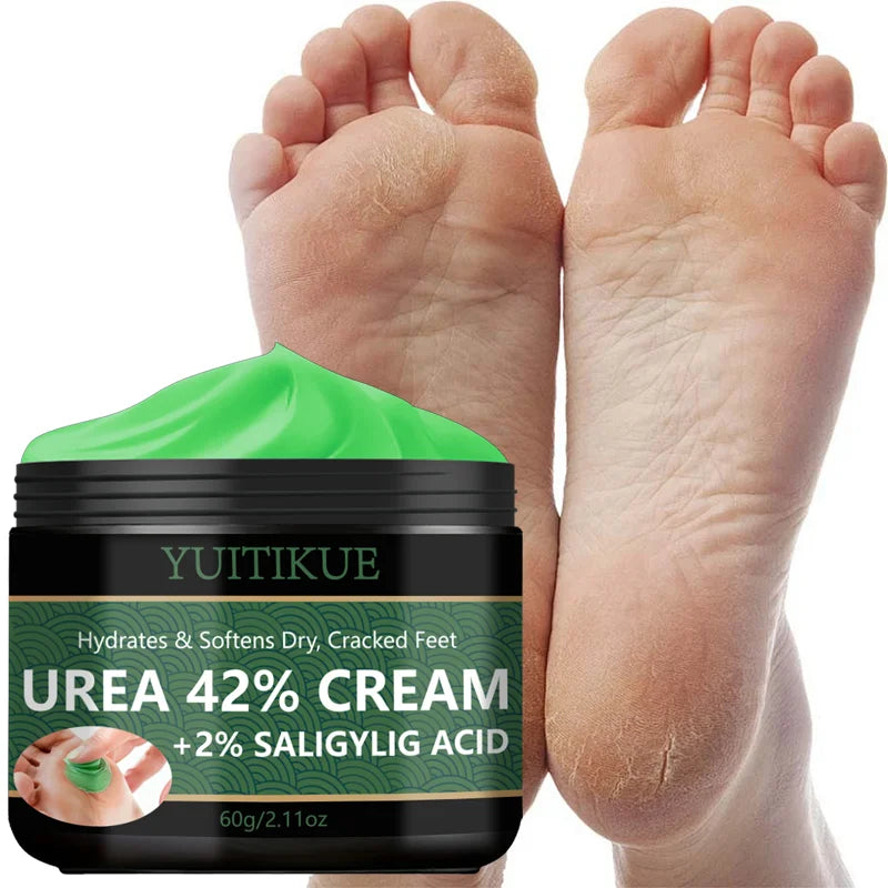 YUITIKUE 42% Urea Foot Cream – Softens Calluses & Hydrates
