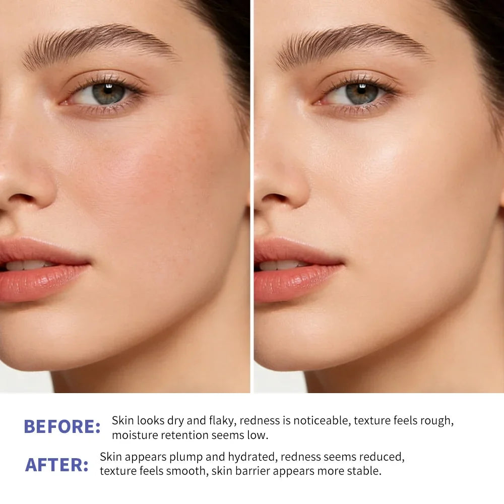 Lakerain Triple Lipid Peptide Cream – Hydrating Moisturizer