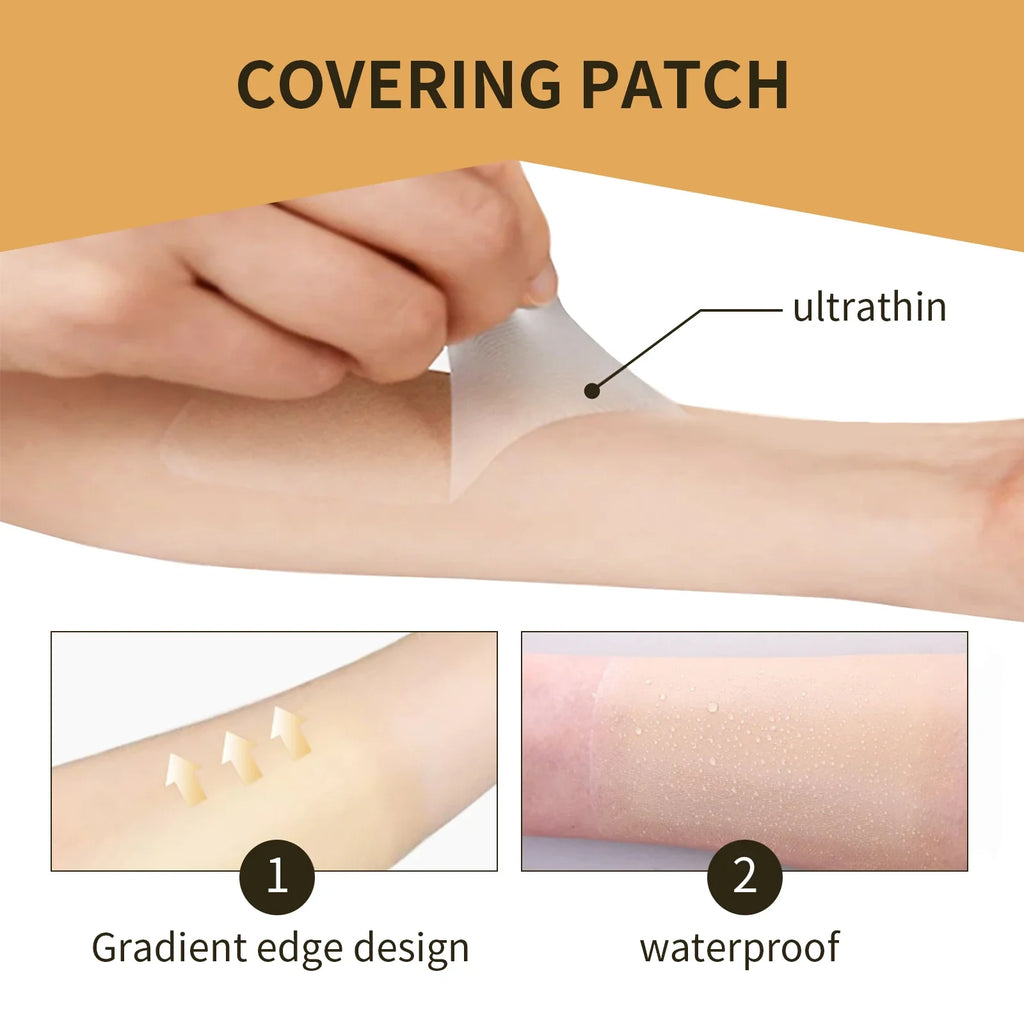 Jaysuing Scar & Tattoo Cover Patches – Waterproof Concealer 6pc