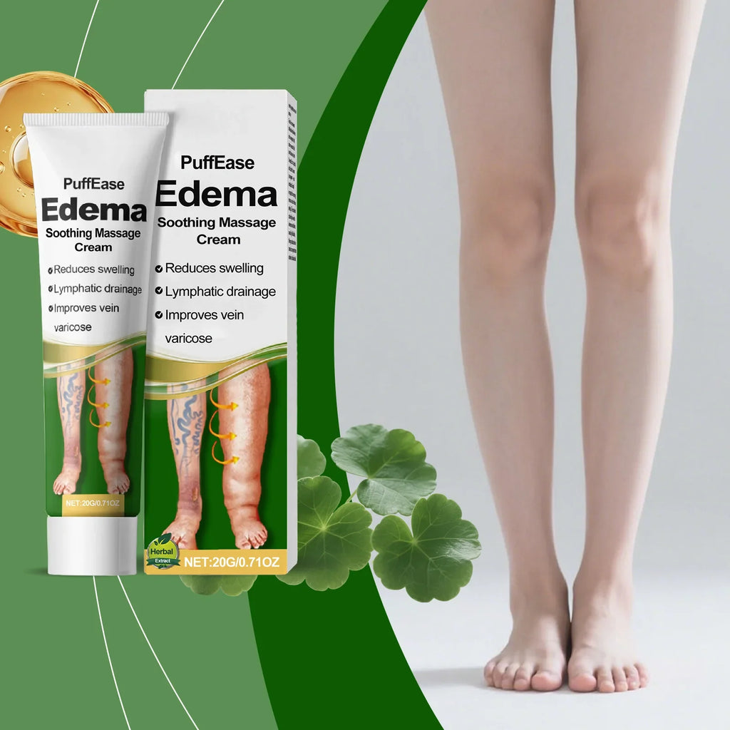 Varicose Vein & Leg Edema Relief Cream | Circulation Boost