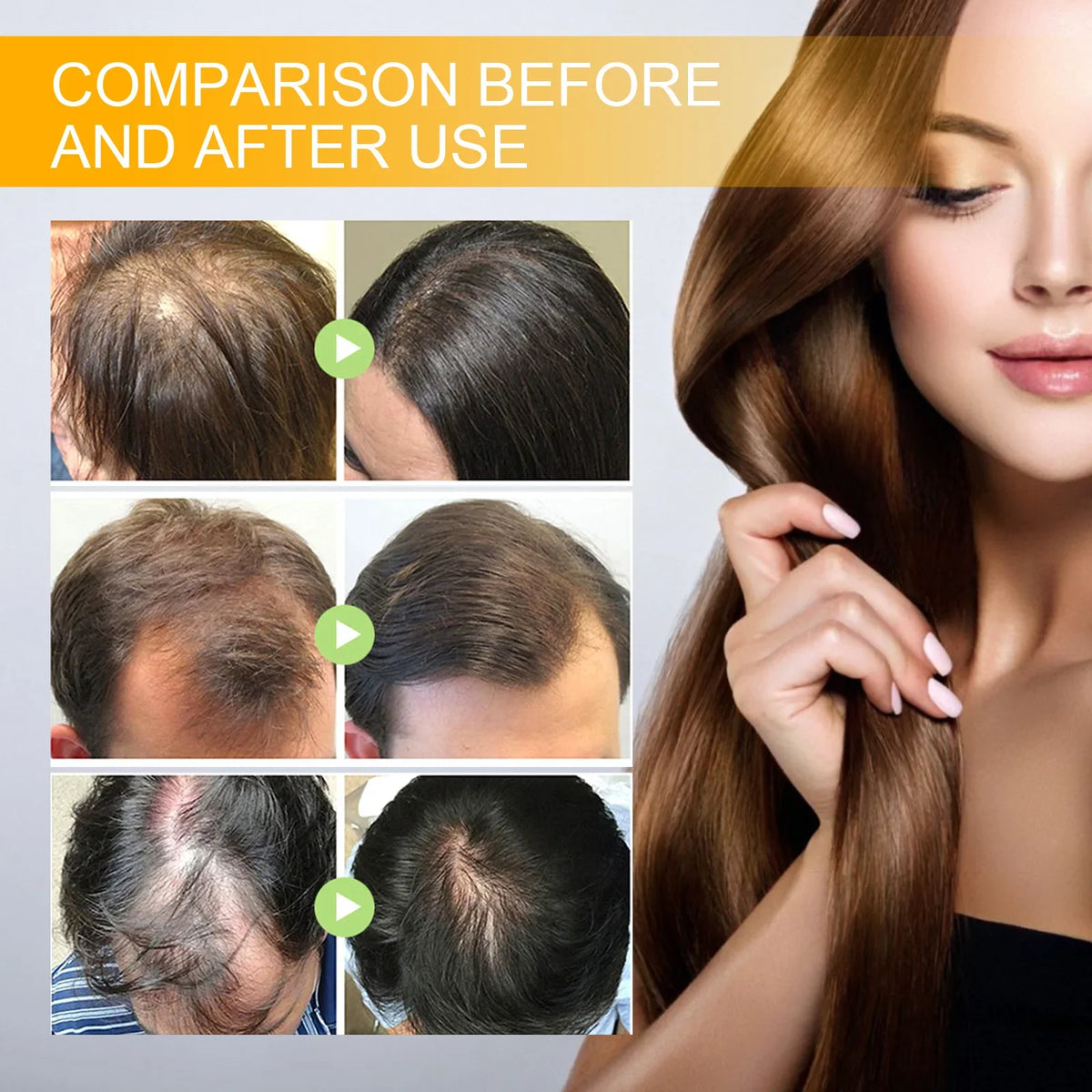 EELHOE Biotin Hair Growth Spray – Scalp Serum & Repair 30ml