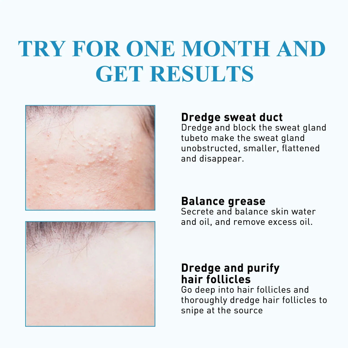 South Moon 144pc Hydrocolloid Blemish Patches | Salicylic & Cica