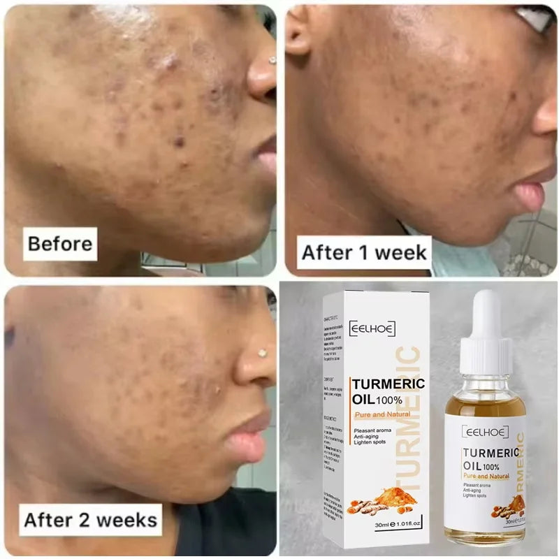 Turmeric Oil Dark Spot Brightening Facial Serum | eelhoe