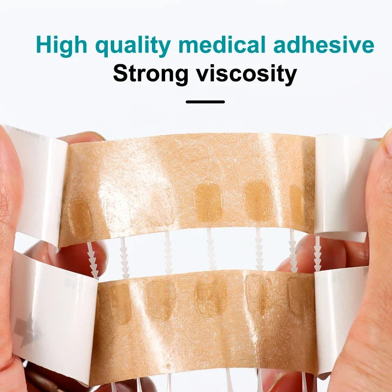 Zipper Wound Closure Patch – Sutureless Hemostatic Bandage