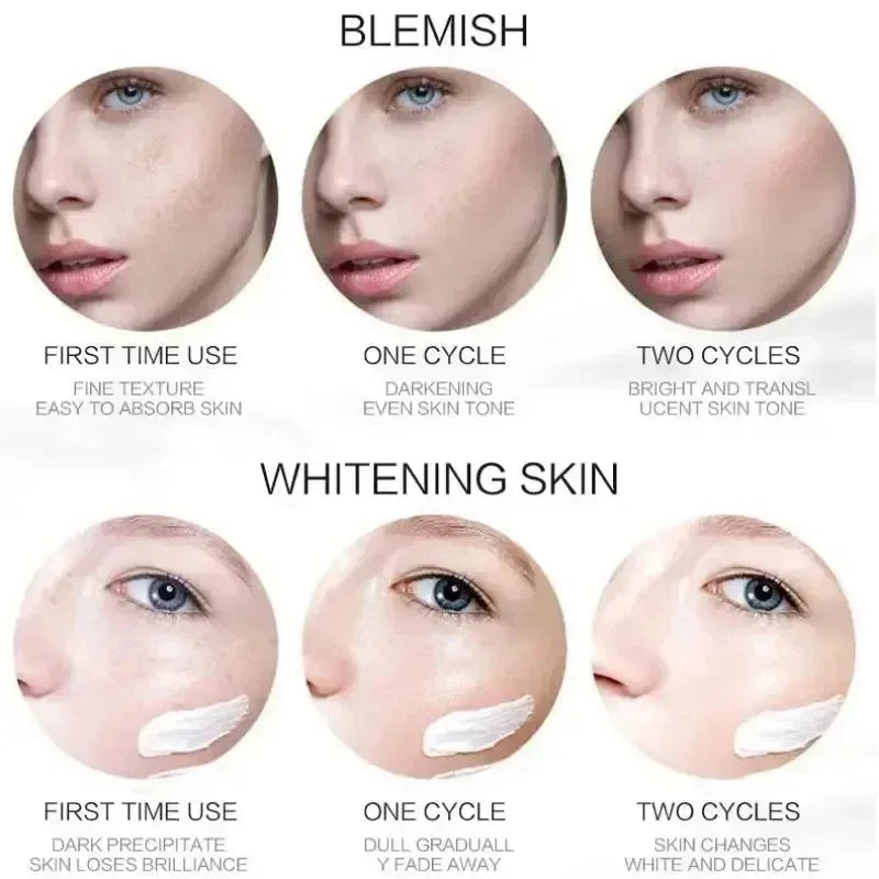 Niacinamide Whitening Freckle Cream | Dark Spot & Melasma