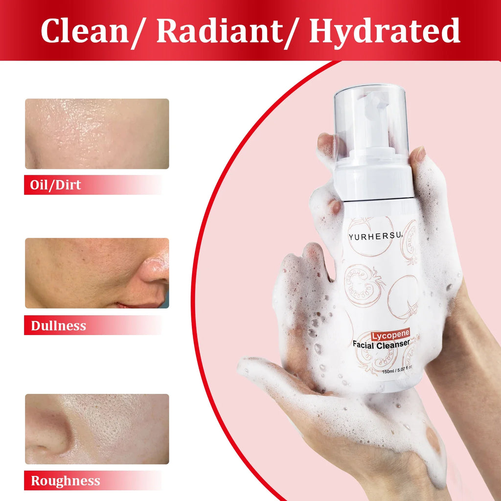Tomato Cleansing Foam – Oil Control & Moisturizing Face Wash