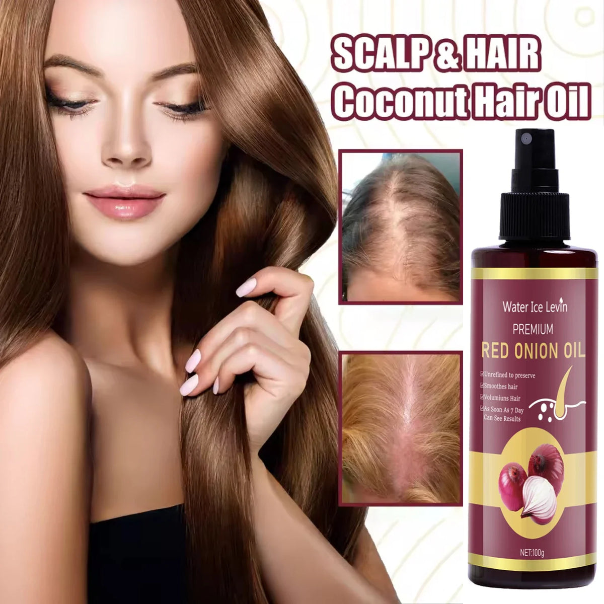 Red Onion Hair Oil with Keratin & Biotin – All Hair Types, 100g