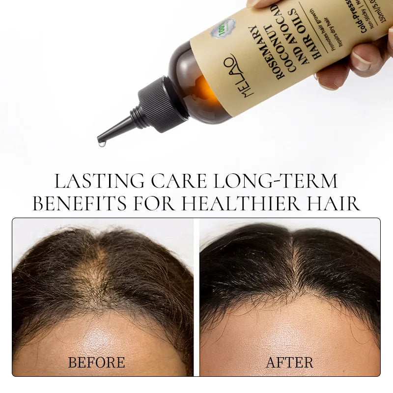 Rosemary Coconut Avocado Hair Scalp Treatment Growth Oil Nourishing
