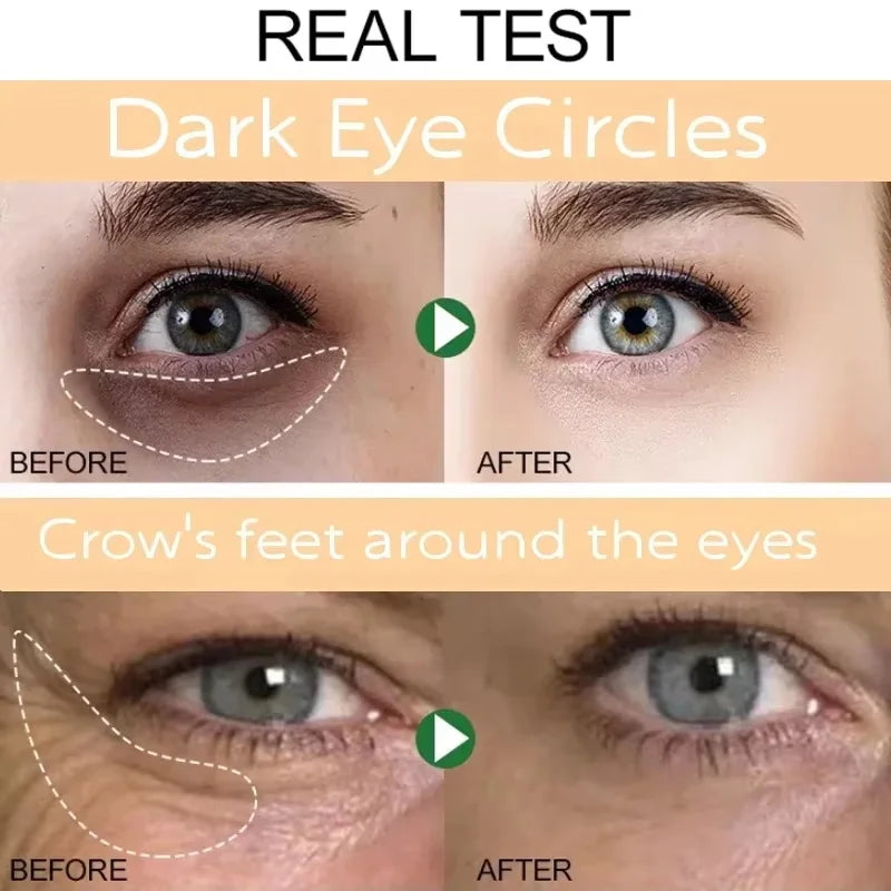 SADOER Retinol Eye Cream – Brighten, Firm & Hydrate