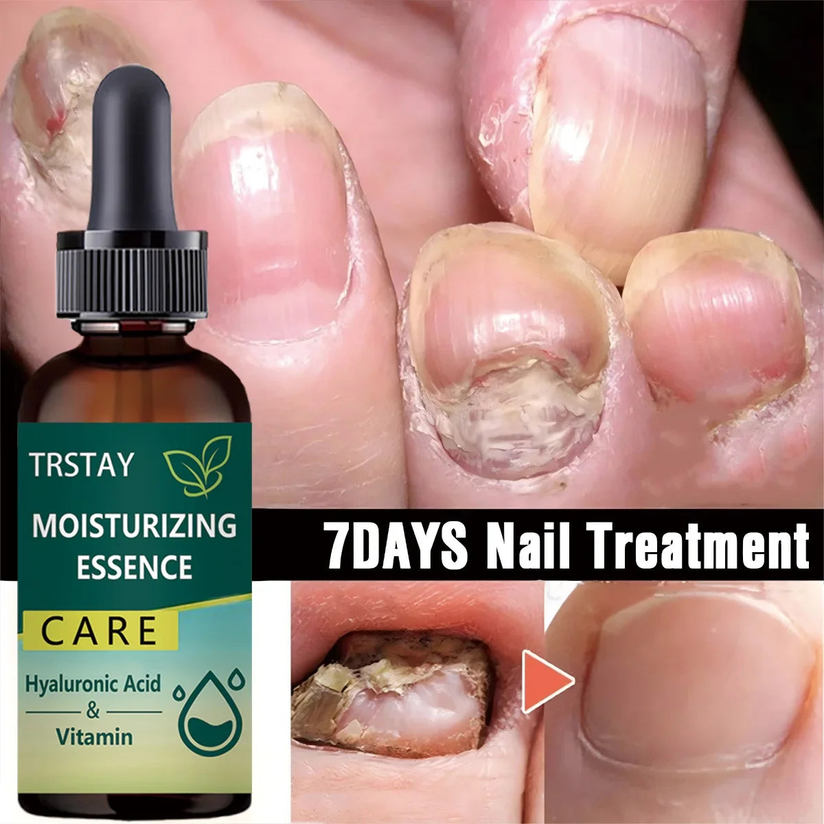 7DAYS Nail Repair Essence Gel – Toe & Foot Care Serum