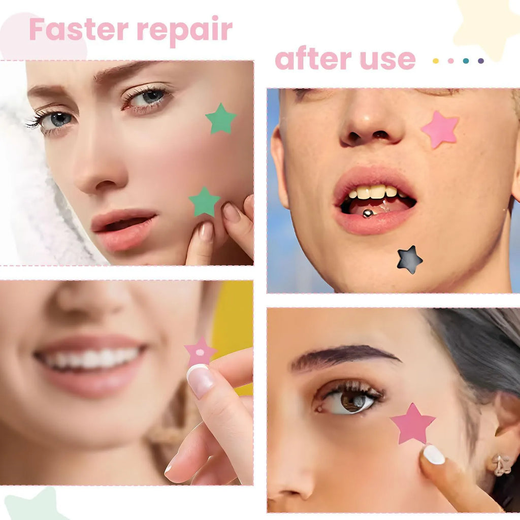 Ultra-Thin Hydrogel Acne Patches – Invisible & Waterproof