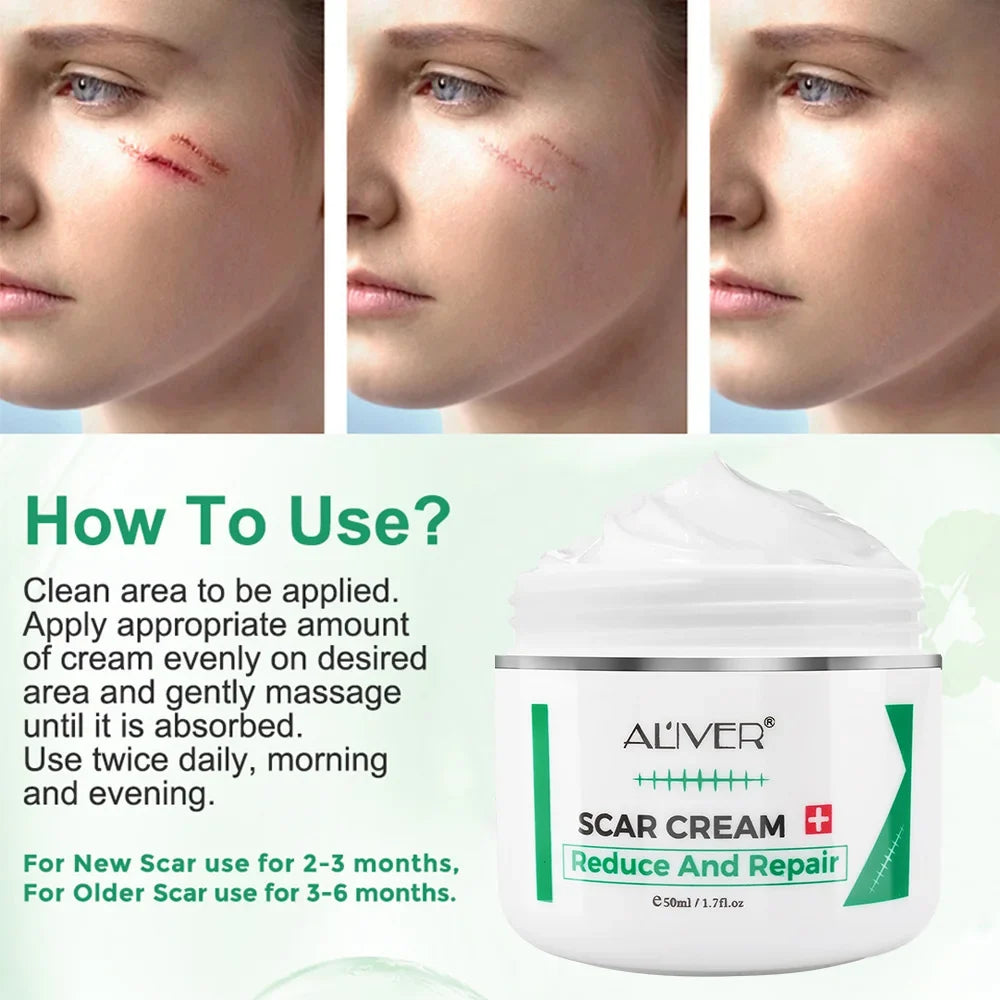 ALVER Acne Scar & Stretch Mark Remover Cream 50ml | Skin Repair