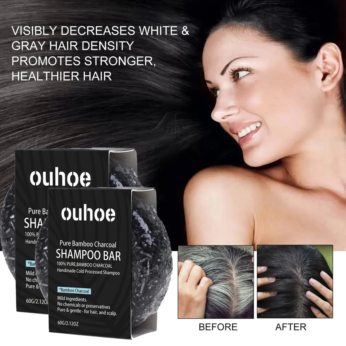 1 2 Charcoal Shampoo Soap Oily Hair Dandruff Treatment Scalp Care