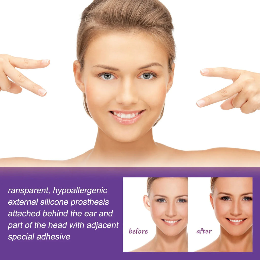 Invisible Ear Correction Tape – Waterproof Cosmetic Patches 6pc
