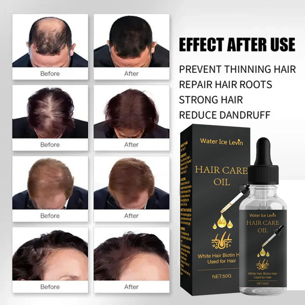 Biotin Hair Oil – Rosemary, Castor Oil & Collagen | 30ml