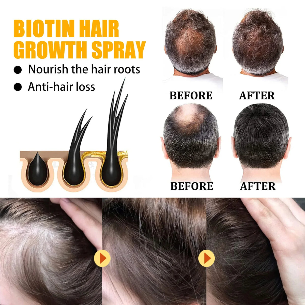 EELHOE Biotin Hair Growth Spray – Scalp Serum & Repair 30ml