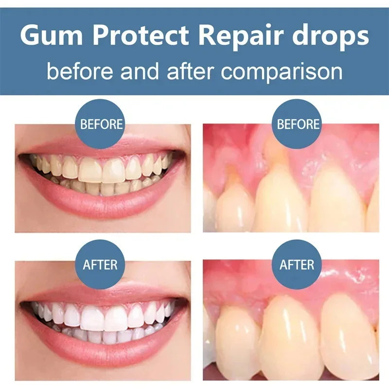 Eelhoe Gum & Tooth Repair Serum | Natural Plant Formula 30ml