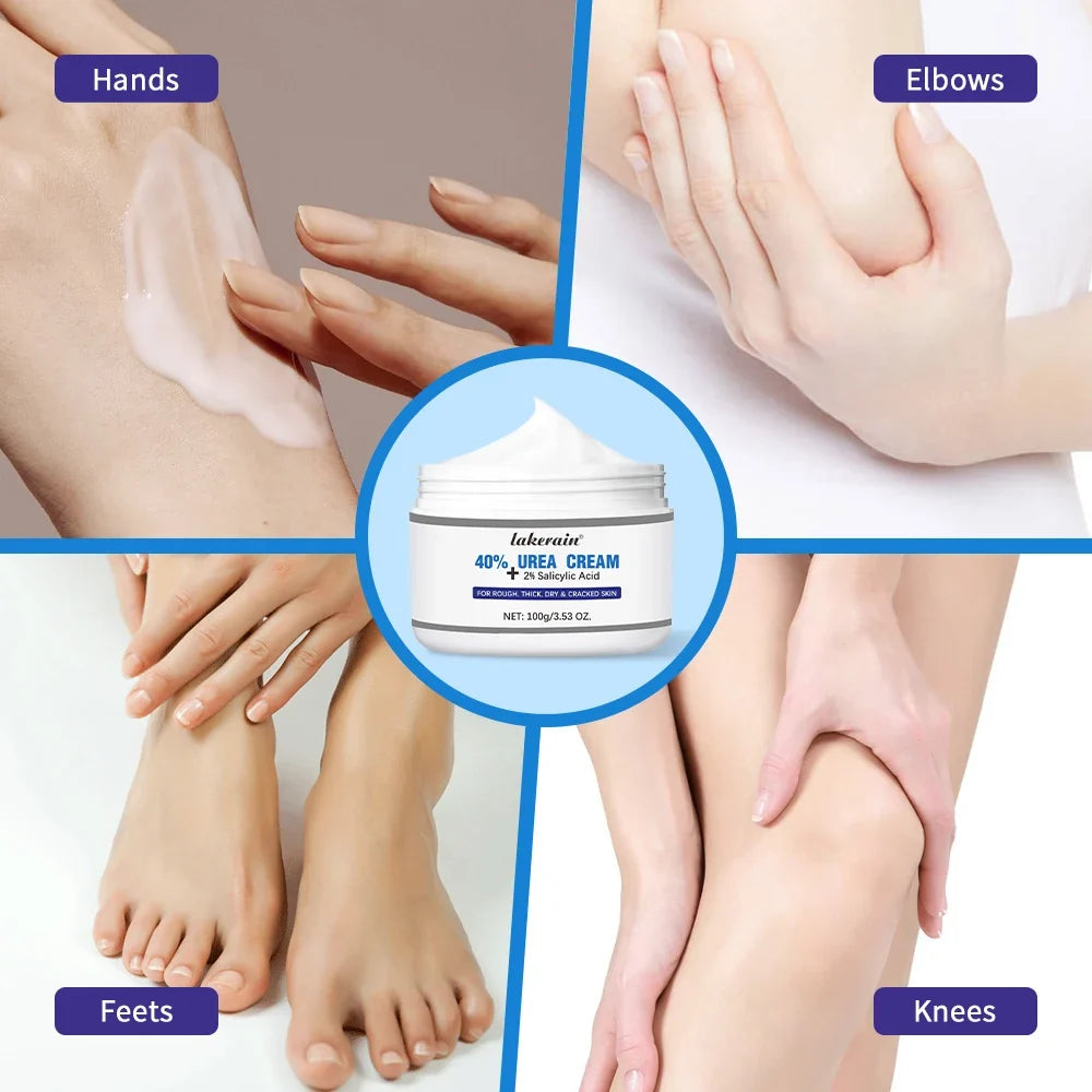 40% Urea Cream + 2% Salicylic Acid Foot & Hand Moisturizer