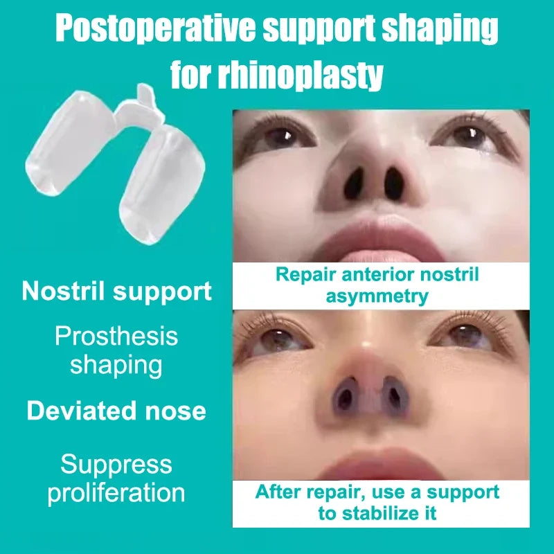 Silicone Nostril Support Clip – Nose Shaping & Breathing Aid