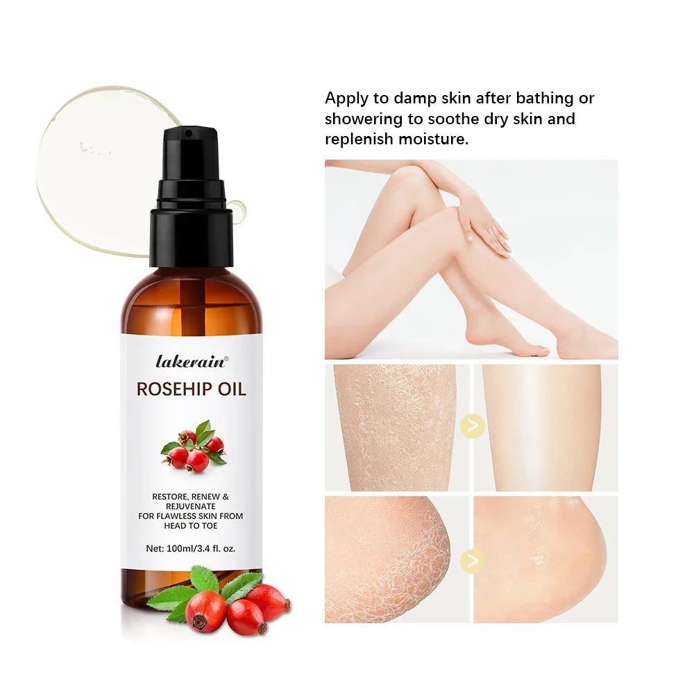 Organic Rosehip Oil 30ml – Face, Body & Hair Moisturizer