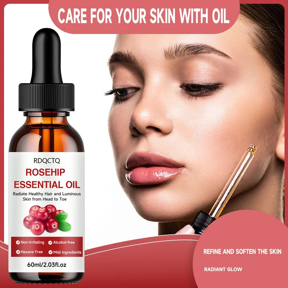 Rosehip Oil for Hair & Skin – Pure Natural Moisturizing Oil