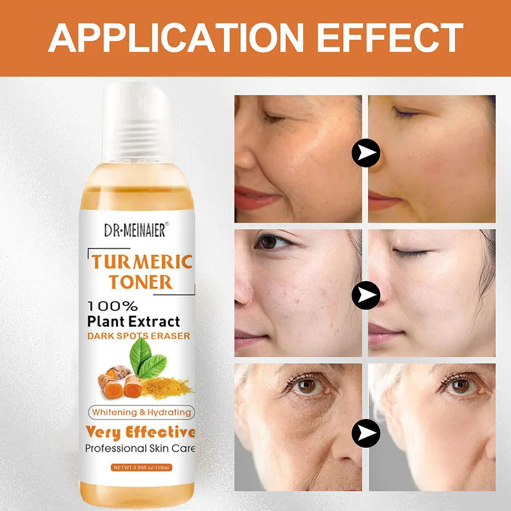 Tumeric Dark Spots Toner Eraser Corrector Turmeric Fade Blemishes