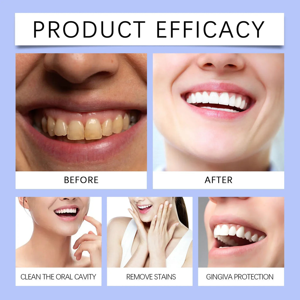 60ml Gum Repair Serum – Deep Cleaning & Fresh Breath Dental Care