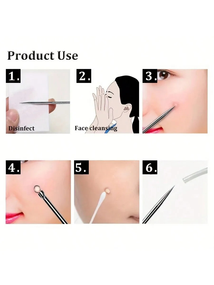 Stainless Steel Blackhead Extractor Tool Set – 4 Piece Kit