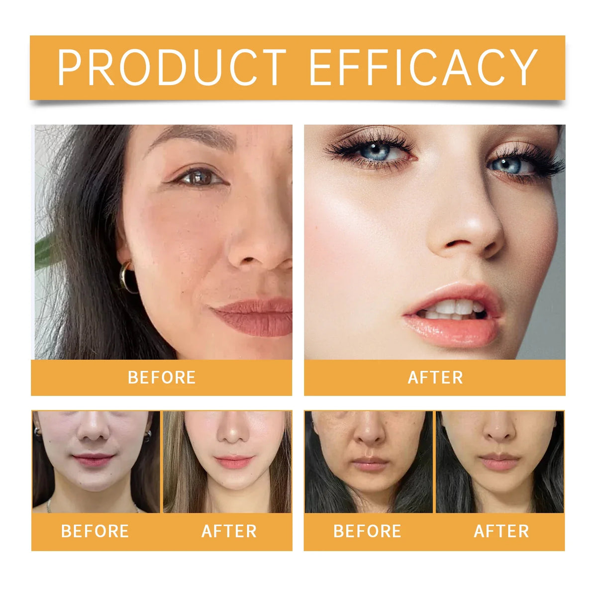 Hyaluronic Acid Nasolabial Fold Patches – Hydrogel Anti-Aging