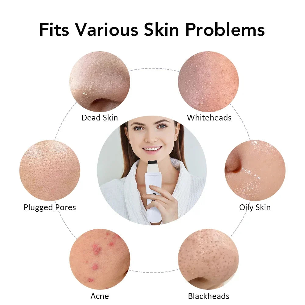 Ultrasonic Skin Scrubber – Blackhead & Deep Pore Cleaner