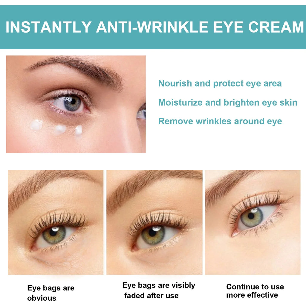 EELHOE Eye Cream – Dark Circles, Bags & Anti-Wrinkle