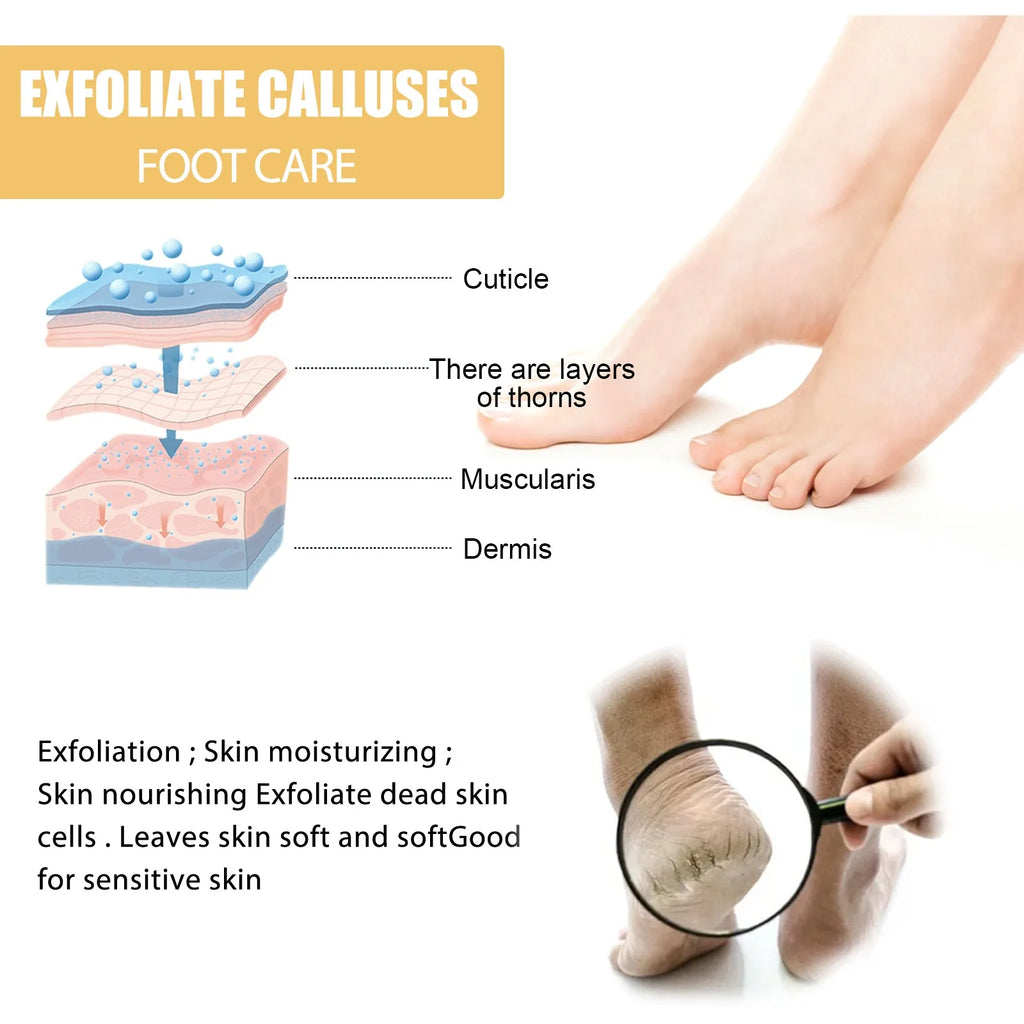 Foot Exfoliating Spray 200ml – Dead Skin & Callus Remover