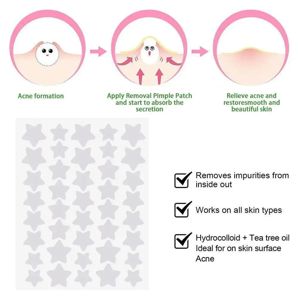 Star-Shaped Colorful Pimple Patches – Invisible Acne Cover 40–120pc