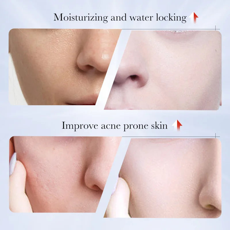 SADOER Kojic Acid Facial Cleanser – Oil Control & Brightening