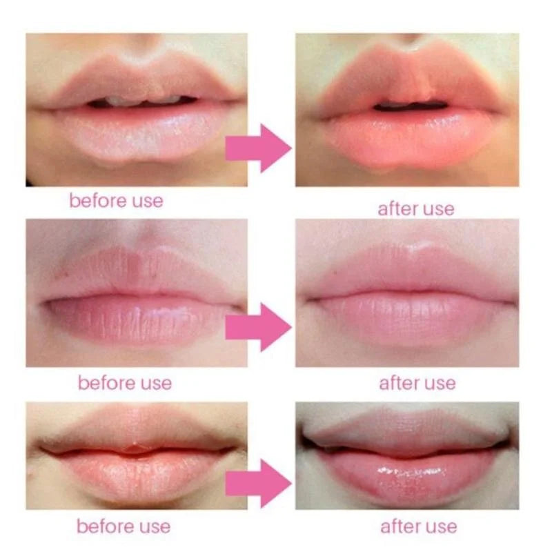 BIOAQUA Cherry Collagen Hydrating Lip Mask 20pcs