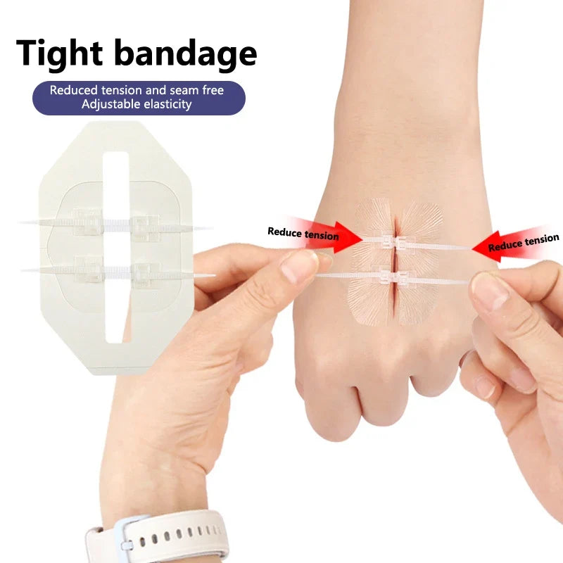 Emergency Wound Closure Zip Stitch Sutures Bandaids Repair Wounds