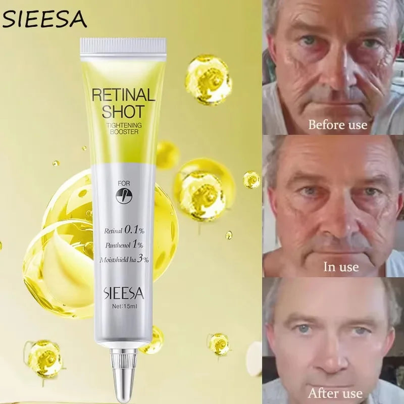 SADOER Retinol Anti-Aging Face & Neck Cream – Firming Moisturizer