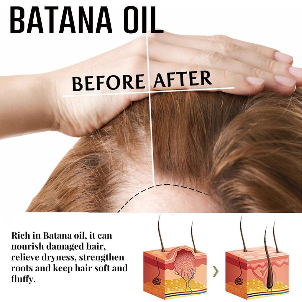 Jaysuing Batana Oil Hair Growth Spray 30ml | Men & Women
