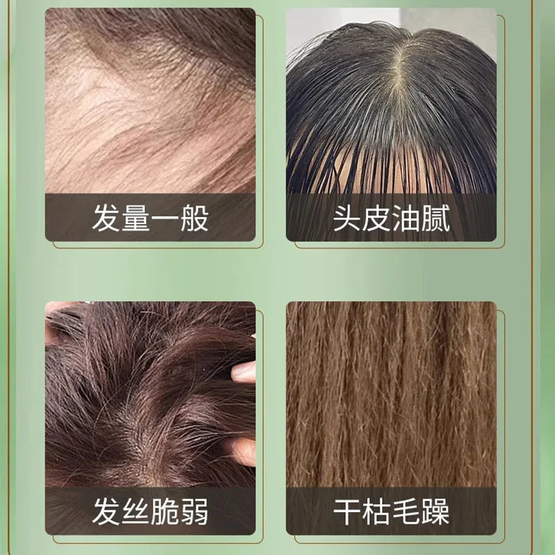 Herbal Hair Strengthening Shampoo 380ml – Scalp & Oil Control