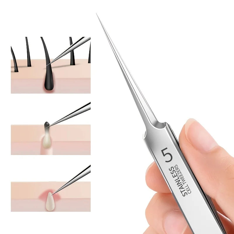 Blackhead & Comedone Extractor Tweezers | Stainless Steel