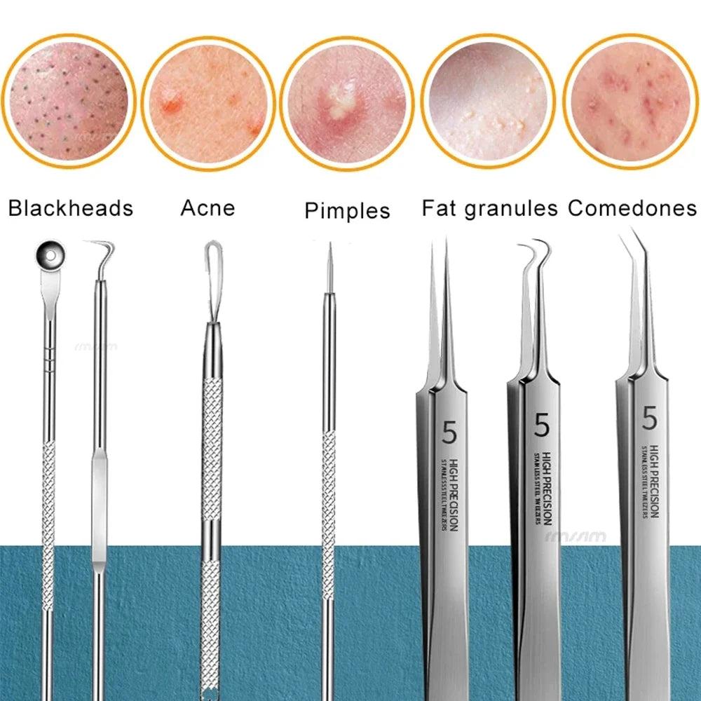 Stainless Steel Blackhead Comedone Extractor Tool Set – 4 Pcs