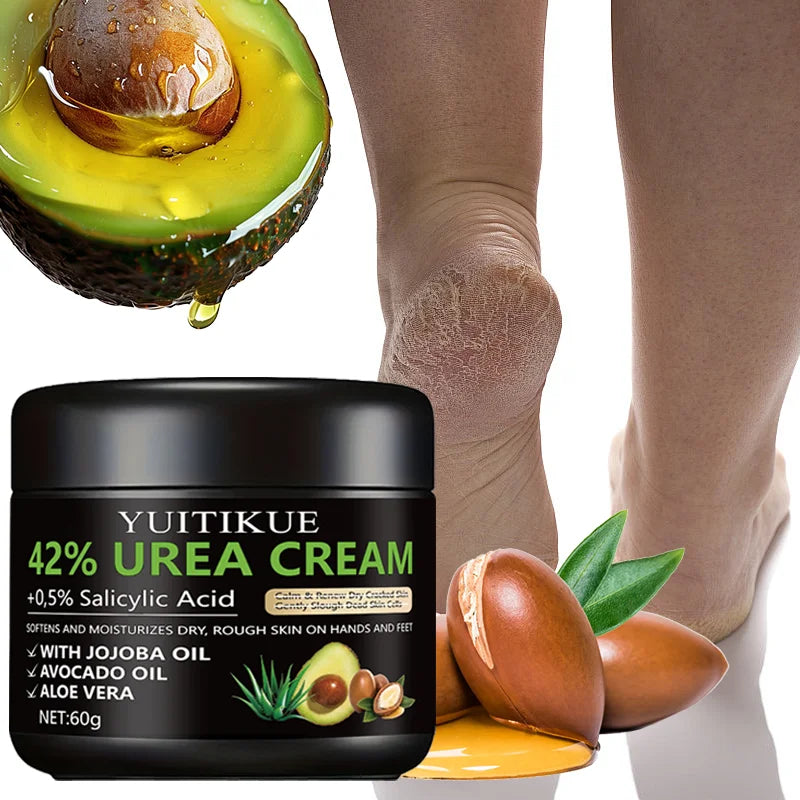 YUITIKUE Urea Foot Cream – Exfoliate, Soften & Hydrate Feet