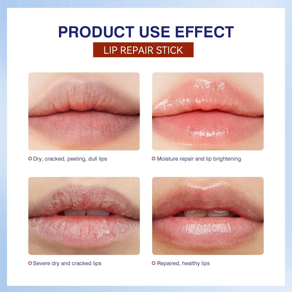 ibcccndc Lip Repair Balm Stick 2-Pack | Moisturizing Lip Care