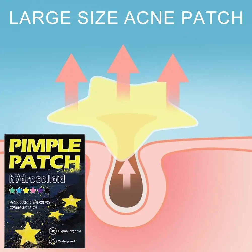 1400-Count Acne Pimple Patches – Absorb Oil & Clear Skin Fast