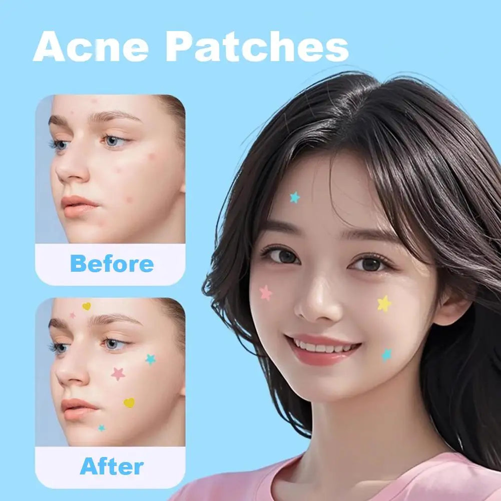 Colorful Star & Heart Acne Patches – 420 to 1260 Pcs
