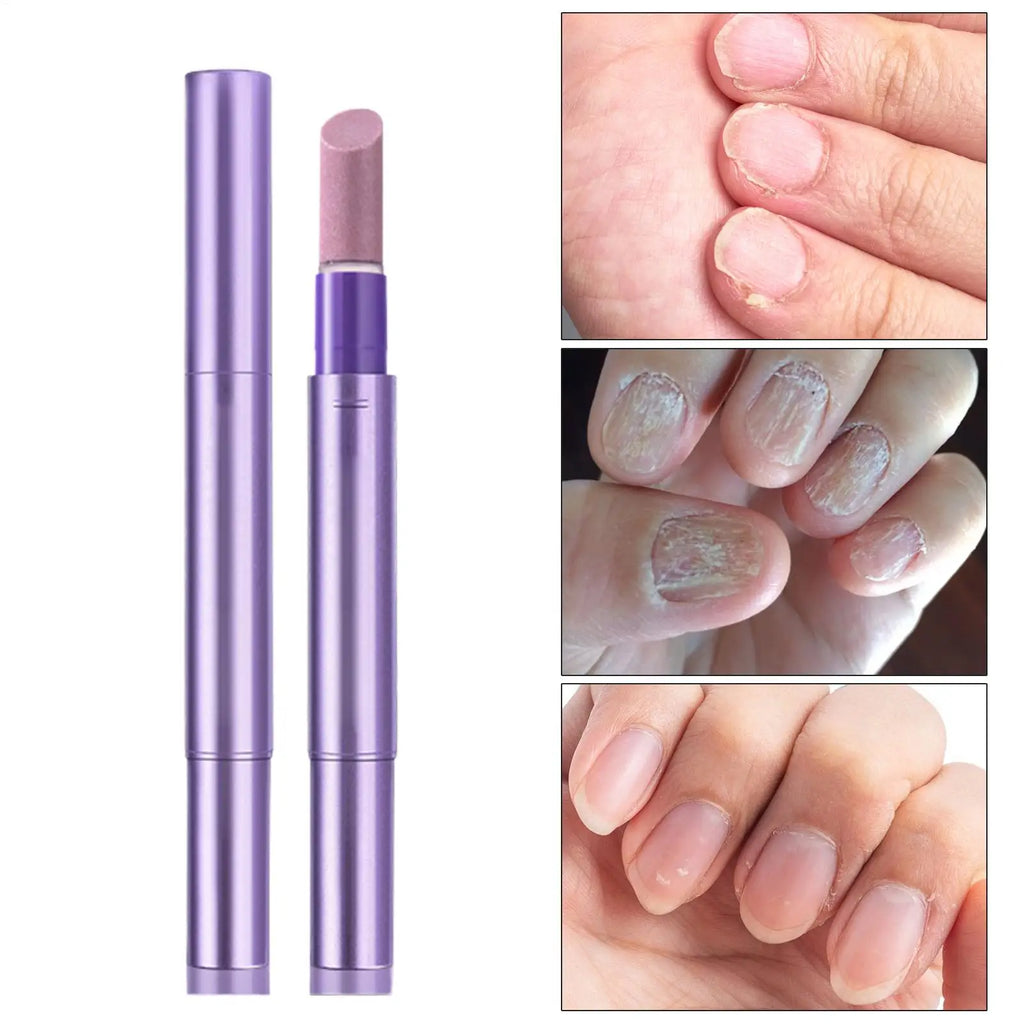 Cuticle Oil Pen – Ceramic Tip Nail Care Tool for Women