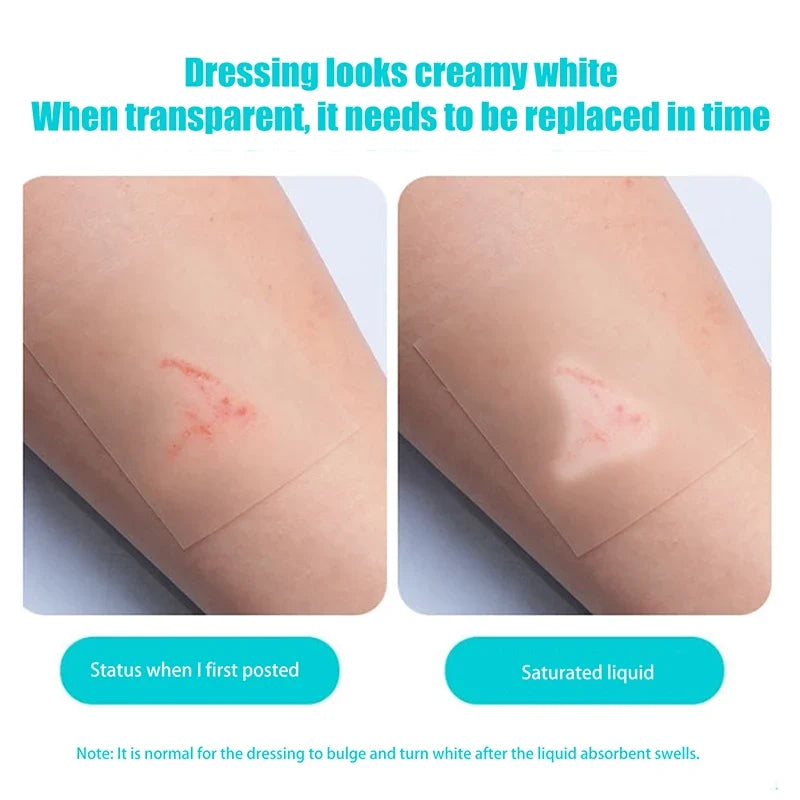 Hydrocolloid Roll Bandage – Waterproof Self-Adhesive Wound Care