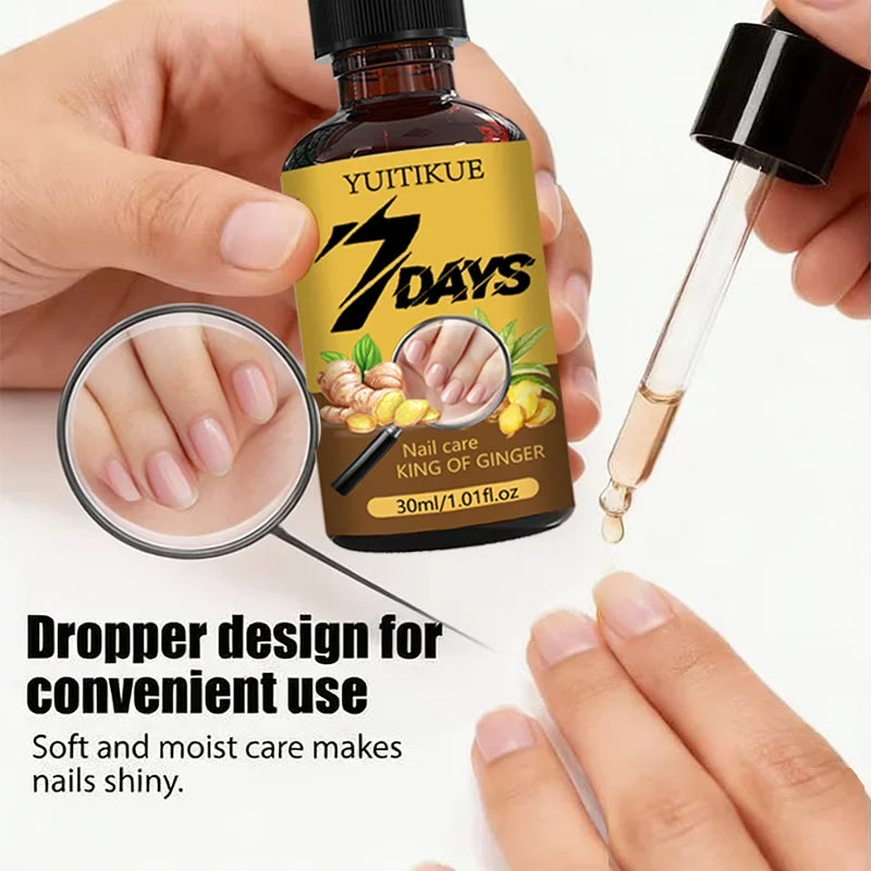 Ginger Nail Care & Cuticle Oil – Strengthen & Nourish 30ml