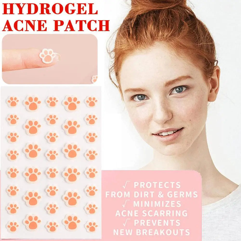 Cat Paw Hydrocolloid Acne Patches 36 Count – Eelhoe